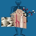 Hilft Aspirin bei Osteoporose?